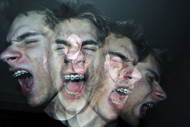 [url=http://shutr.bz/16SPcFZ]"Szablozębni". Czy aparat na zębach trzydziestolatka to obciach[/url]