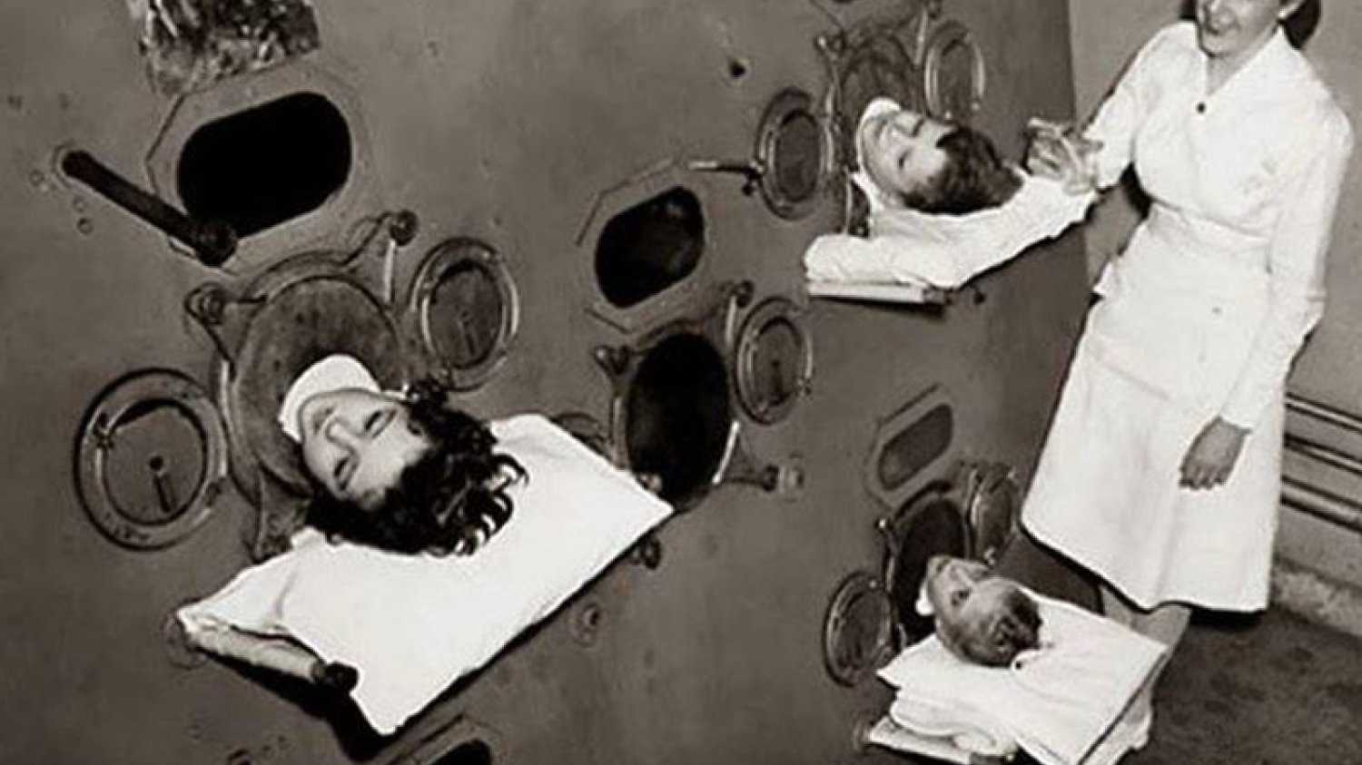 Żelazne płuco – urządzenie, które ratowało życie dzieciom chorym na polio, u których wystąpiło porażenie mięśni oddechowych. Stosowane w pierwszej połowie XX w.