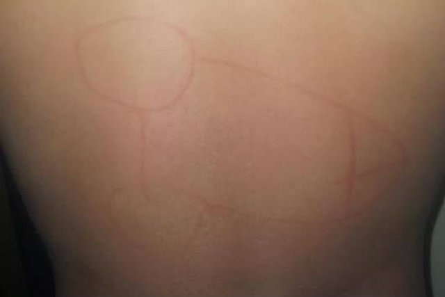 Nad Mateuszem z Gliwic przez dwa tygodnie znęcali się inni chłopcy, uczestnicy kolonii. Opiekunowie o wszystkim wiedzieli, jednak uznali, że to normalne, że dzieci sobie dokuczają.