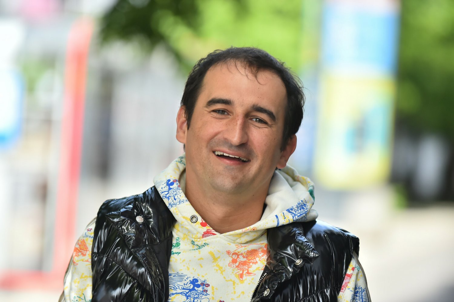 Michał Koterski postanowił poddać się operacji przeszczepu włosów w Turcji.