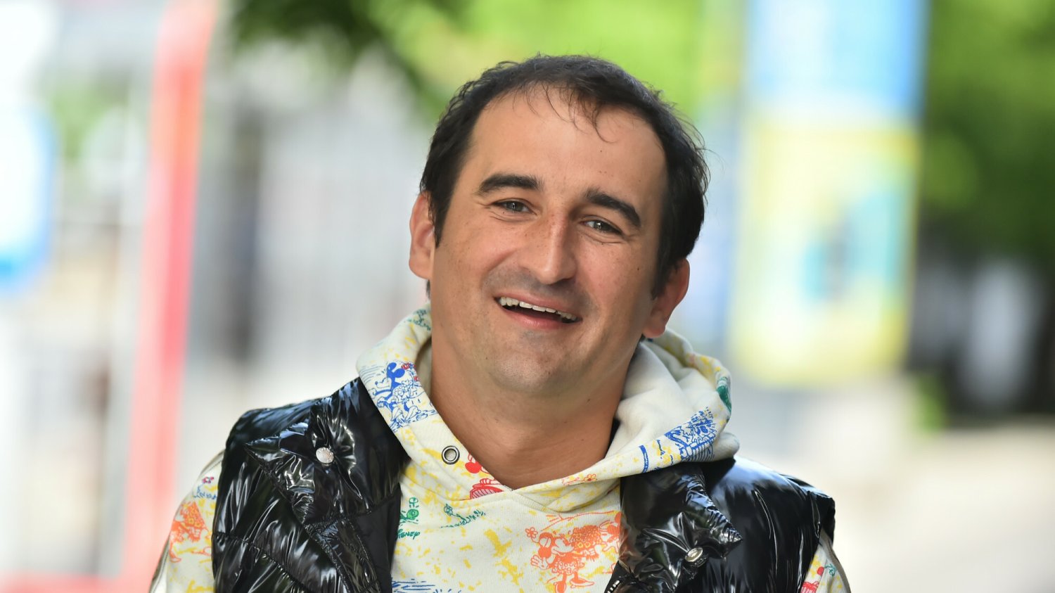 Michał Koterski postanowił poddać się operacji przeszczepu włosów w Turcji.