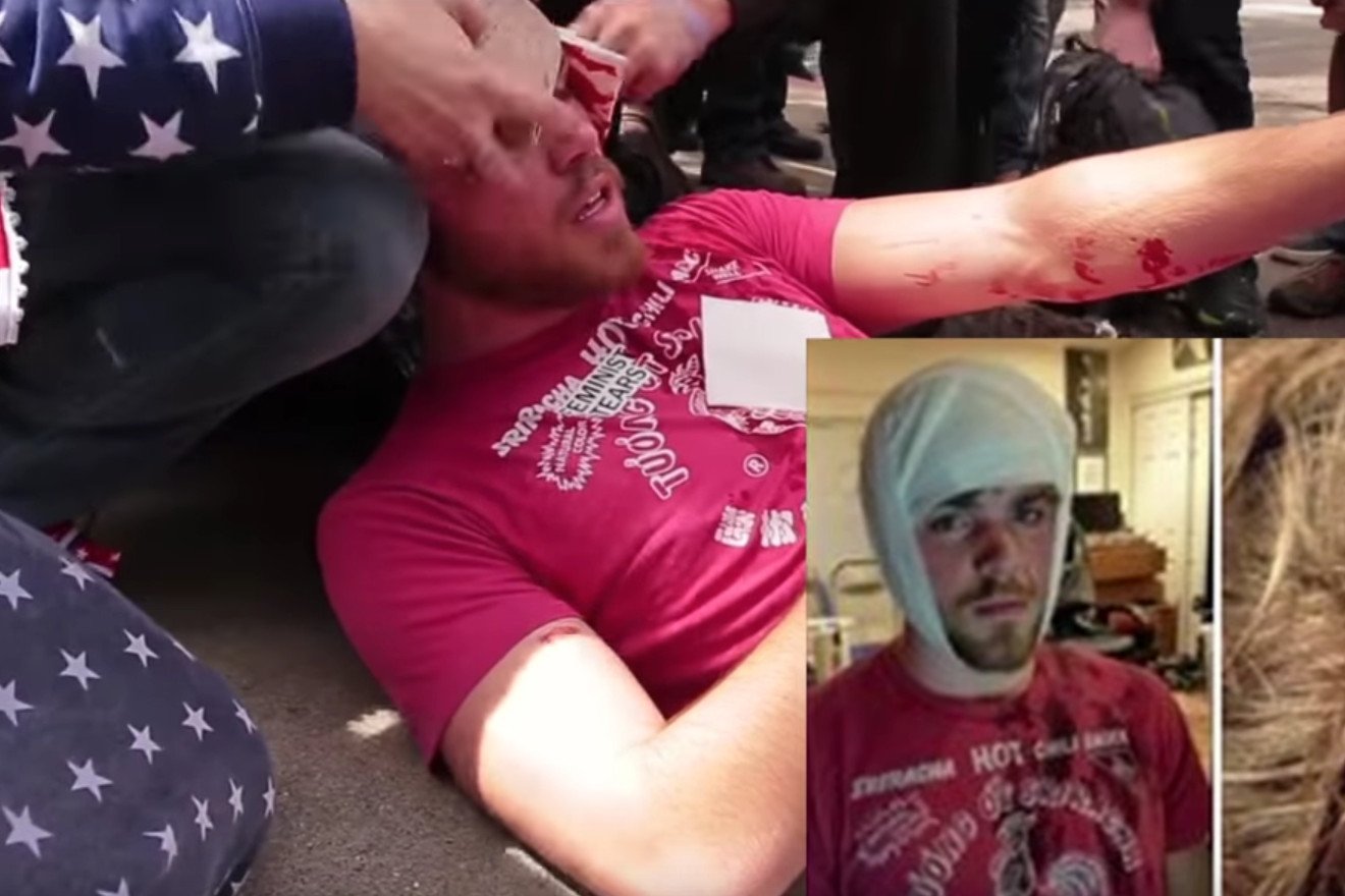 Ten mężczyzna został zaatakowany z ukrycia, ale napastnik szybko się odnalazł.