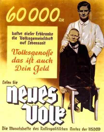 Plakat niemiecki propagujący eutanazję chorych z wadami wrodzonymi. "Utrzymanie tego chorego kosztuje 60 tysięcy marek. Rodaku, to są także twoje pieniądze!"