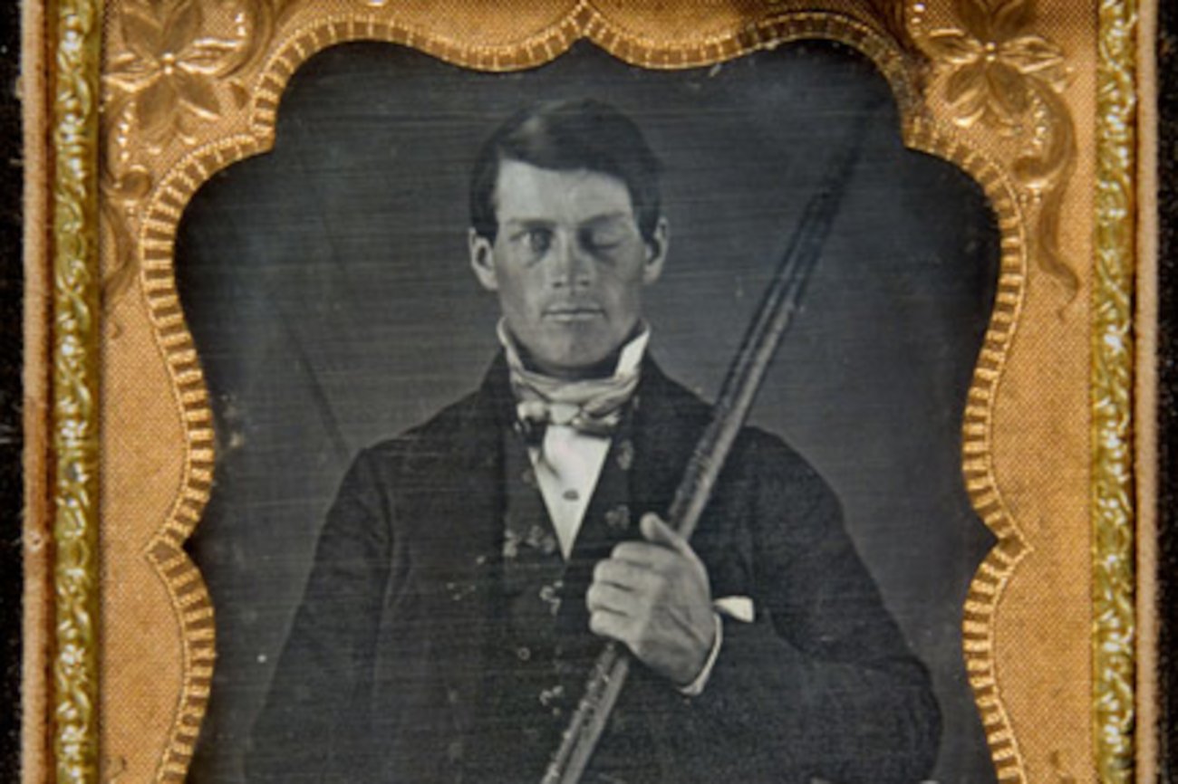 Ciekawy przypadek Phineas'a Gage'a – człowieka z dziurą w głowie.