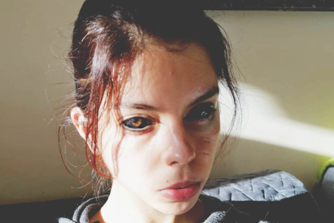 Aleksandra z Wrocławia wytatuowała sobie gałki i oślepła. Zapadł wyrok