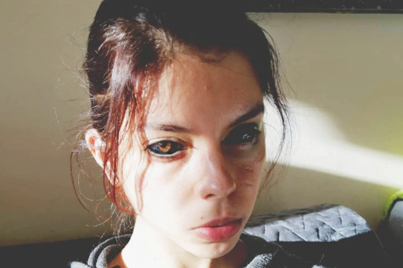 Aleksandra z Wrocławia wytatuowała sobie gałki i oślepła. Zapadł wyrok
