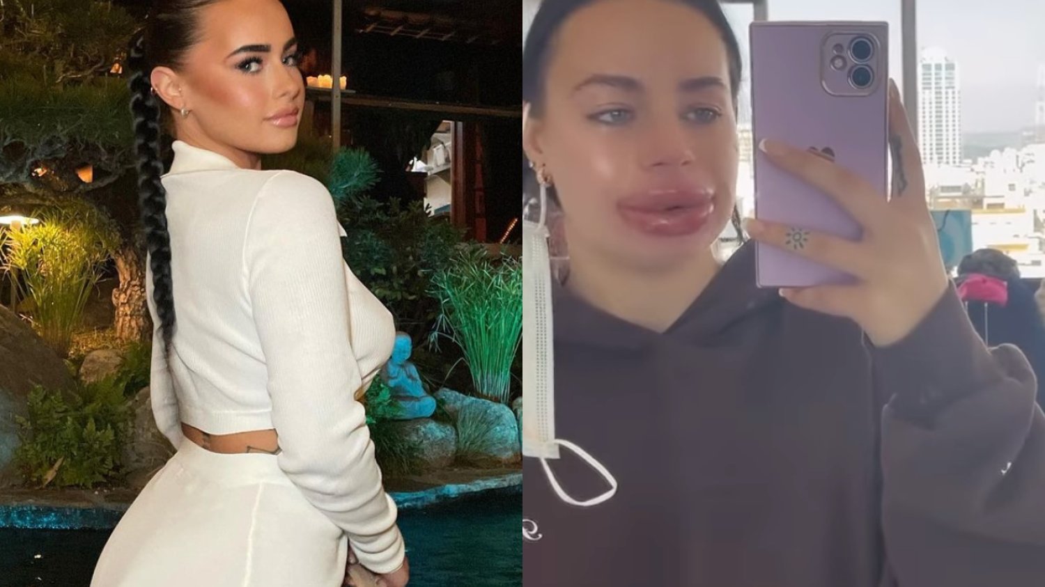 Influencerka, Jessica Burko powiększyła usta. Po zabiegu była załamana