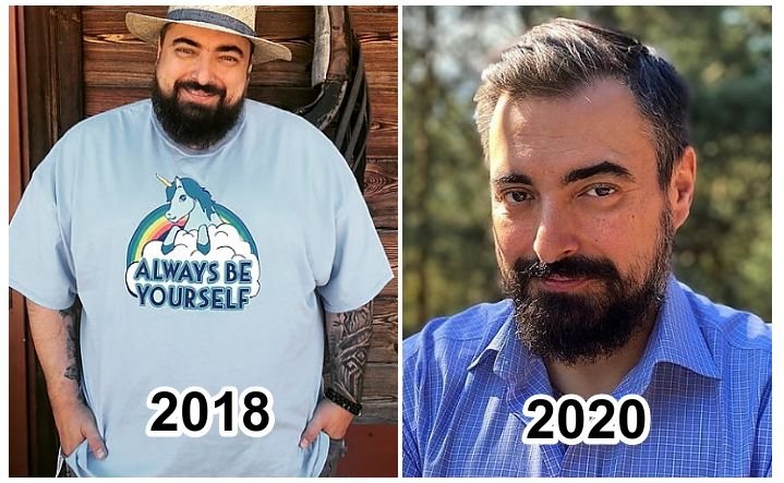 Niesamowitą metamorfozę Tomasz Sekielski zawdzięcza operacji bariatrycznej, dzięki której udało się mu zrzucić 65 kg. Metamorfoza Tomasza Sekielskiego, który schudł 65 kg.