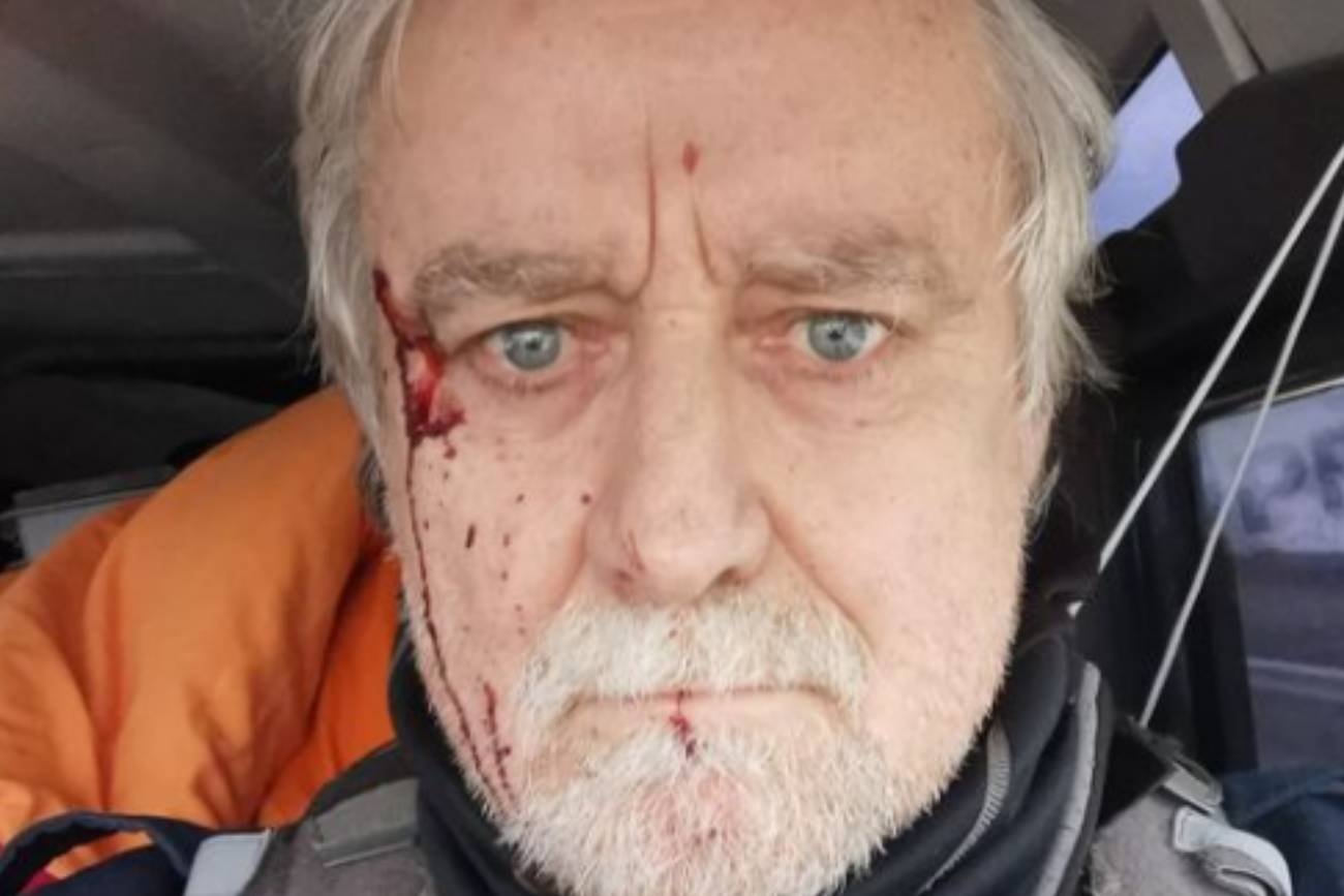 Szwajcarski dziennikarz ostrzelany przez rosyjskich żołnierzy