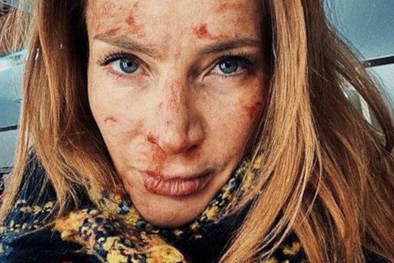 Anna Dereszowska zaskoczyła fanów nowym zdjęciem.