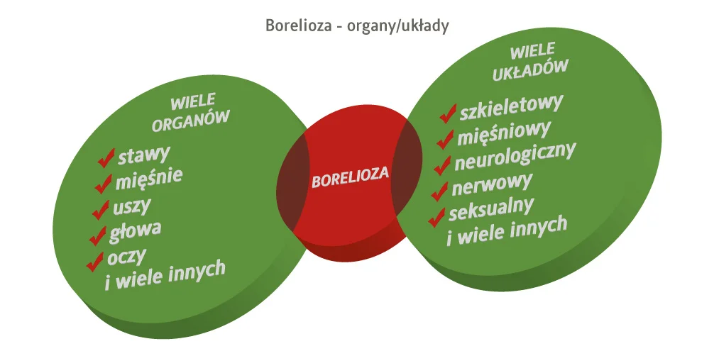 borelioza a organy i układy