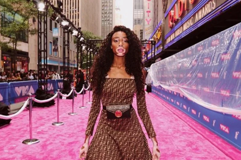 Winnie Harlow wystąpi w listopadowym show Victoria's Secret