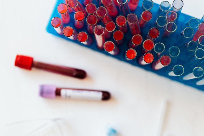 Ryzyko zakrzepicy po zachorowaniu na Covid-19 większe niż po szczepionce.