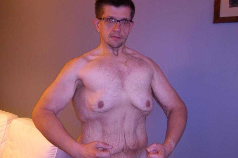 Tomasz Przeorski od lata zmaga się z nadmiarem skóry.