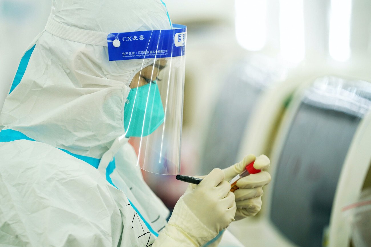 Naukowcy odkryli nowego koronawirusa NeoCov.