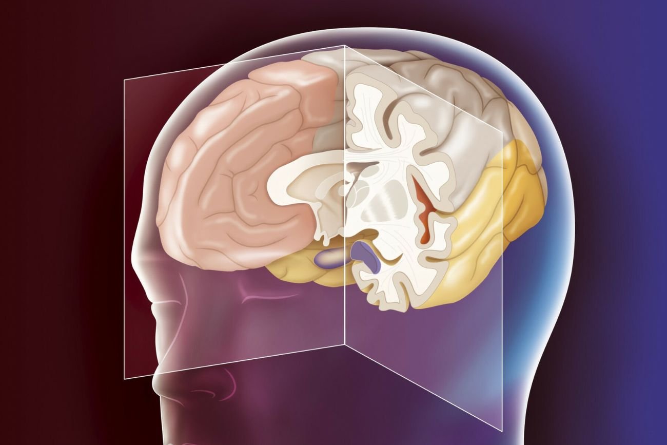 Sensacyjne odkrycie naukowców. Mózgi z XVII zawierały nakrotyki