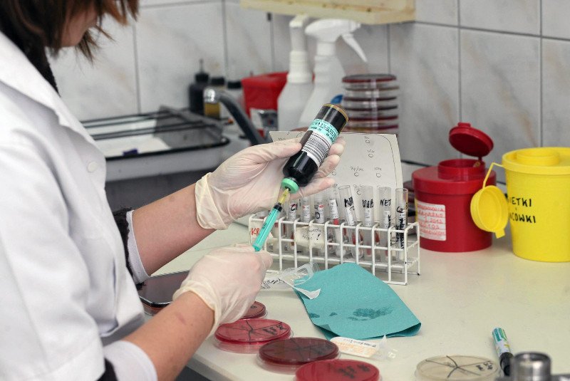 Diagnostyka laboratoryjna jest konieczna do postawienia trafnej diagnozy