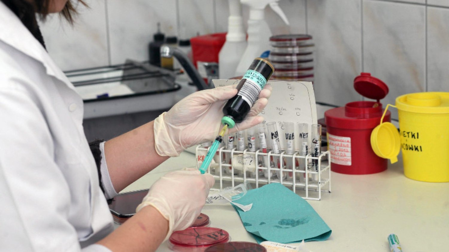Diagnostyka laboratoryjna jest konieczna do postawienia trafnej diagnozy