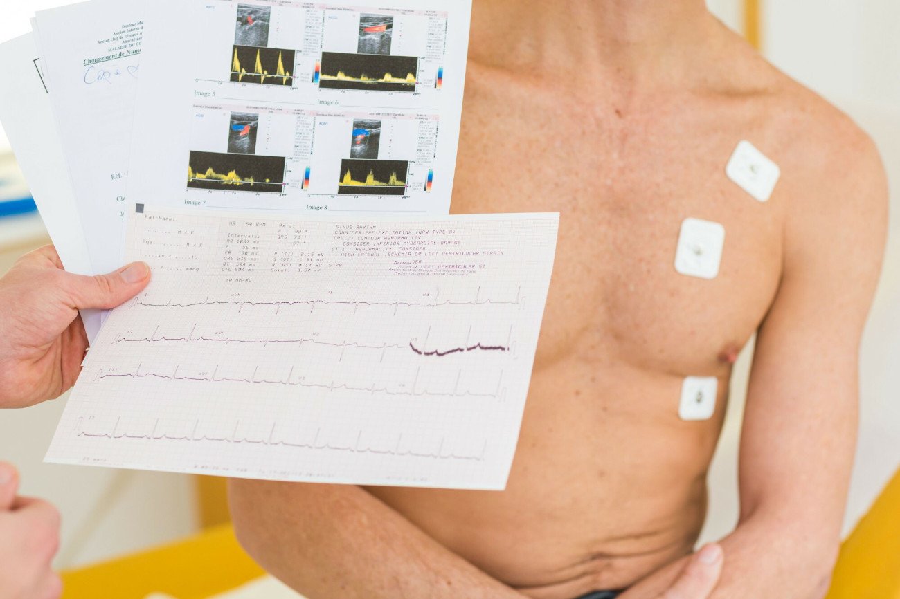 Niewydolność serca coraz częściej diagnozowana jest też wśród młodszych osób.