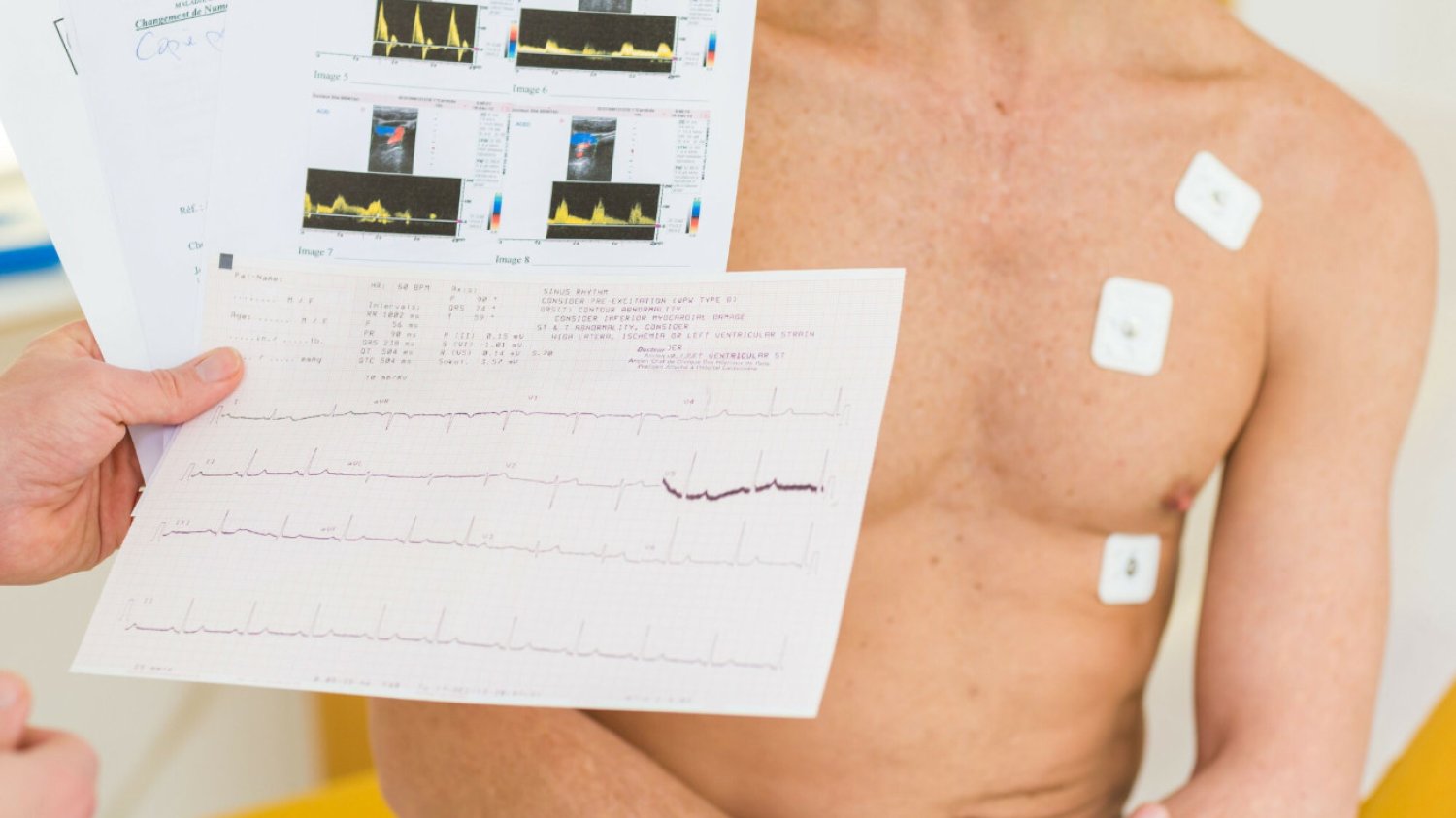 Niewydolność serca coraz częściej diagnozowana jest też wśród młodszych osób.