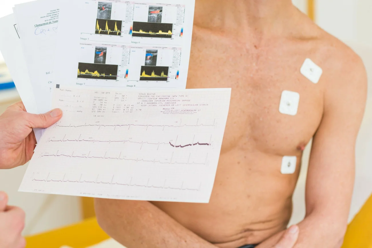 Niewydolność serca coraz częściej diagnozowana jest też wśród młodszych osób.