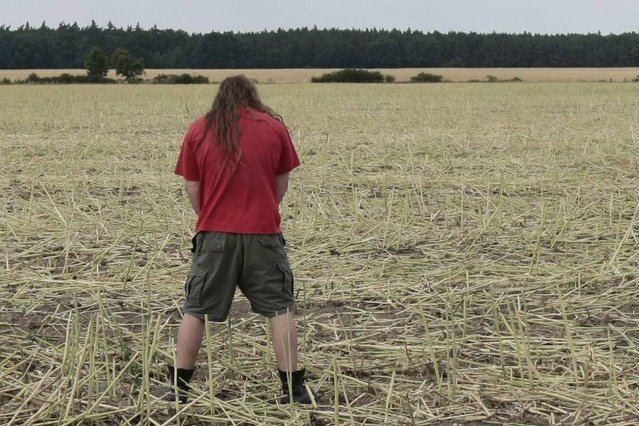 Częste infekcje układu moczowego mogą być pierwszym objawem rak nerki.