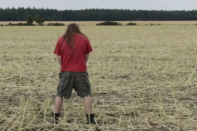 Częste infekcje układu moczowego mogą być pierwszym objawem rak nerki.