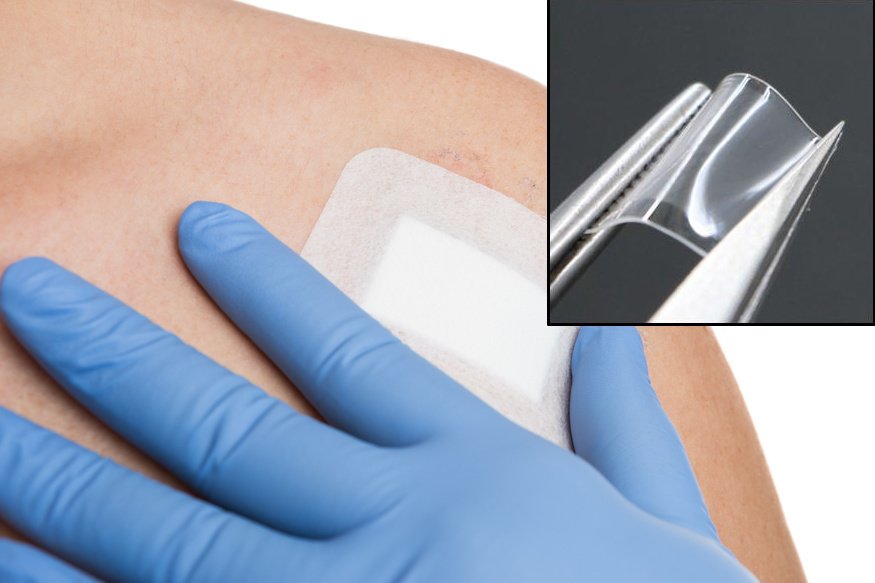 Plaster na czerniaka? Nowy sposób leczenia śmiertelnie niebezpicznej choroby skóry