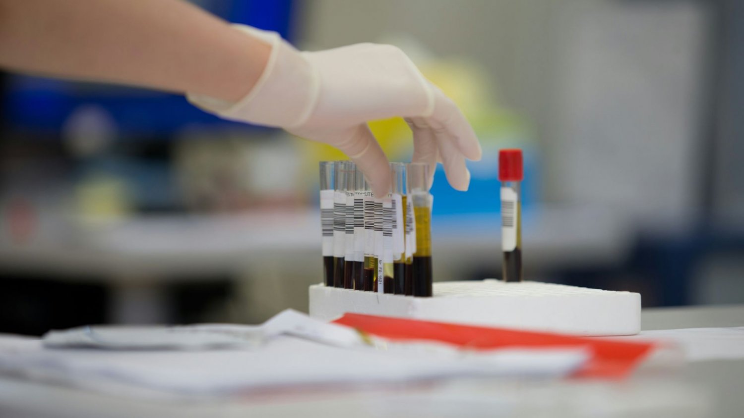 Bezpłatny test FIT-OC dla Polaków 50+. Większość odkłada go na wieczne nigdy