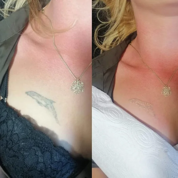 Zawsze po odbiciu kalki możesz zrezygnować z tatuowania. Pamiętaj o tym