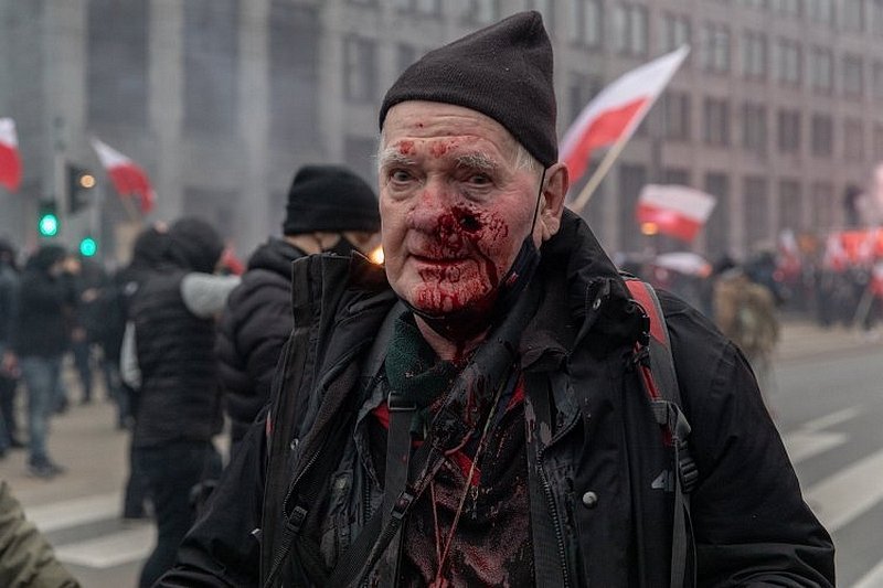 Tomasz Gutry został postrzelony podczas Marszu Niepodległości. Jest już po operacji.