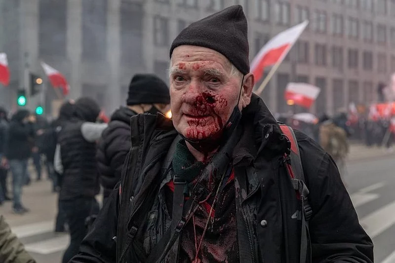Tomasz Gutry został postrzelony podczas Marszu Niepodległości. Jest już po operacji.