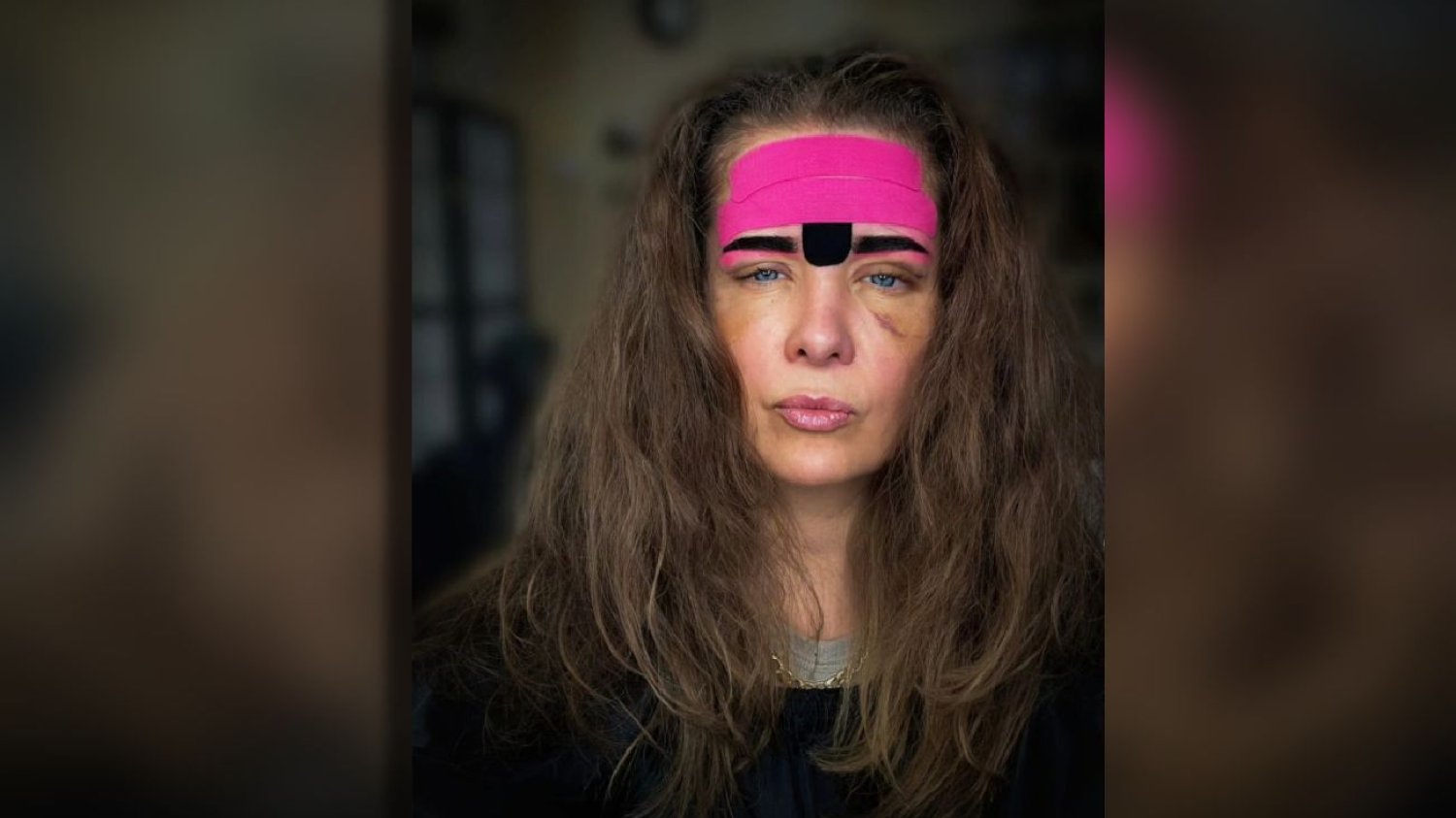Anna Powierza opublikowała zdjęcie z siniakami