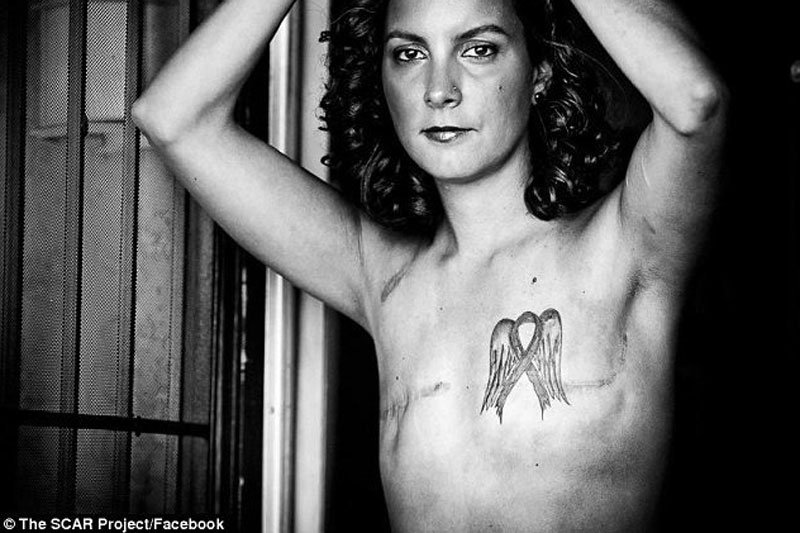 Takich zdjęć osób po mastektomii Facebook już nie uważa za pornografię.