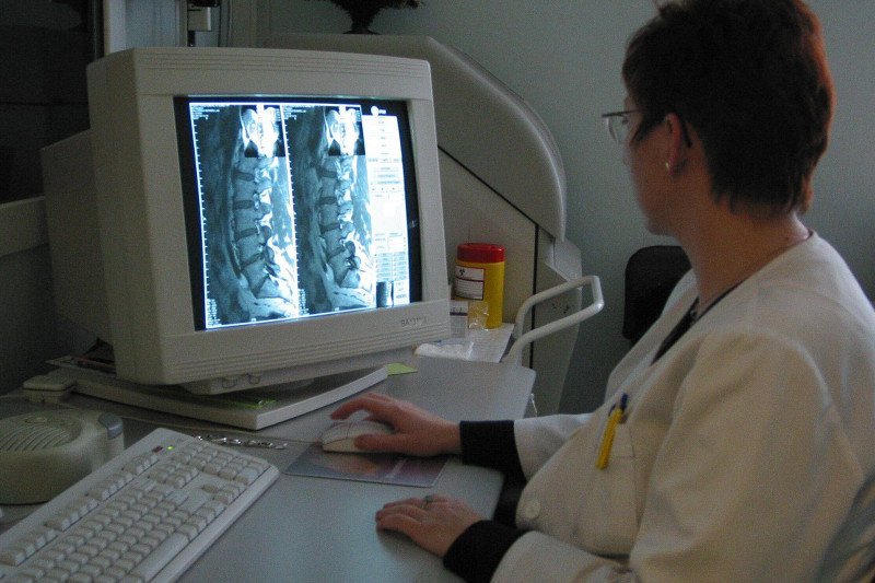 Operacja kręgosłupa to ostateczność, jednak jeśli jest konieczna, nie ma co zwlekać.