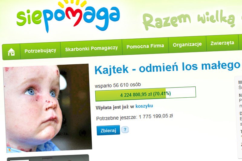 Pieniądze na leczenie Kajtka zebrano w ekspresowym tempie. Tu wielkie zasługi mają przede wszystkim internauci, którzy masowo dzielili się informacjami o tej akcji.