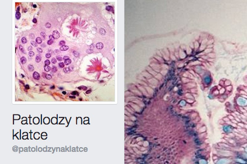 Obrazy chorych tkanek mogą być fascynujące.