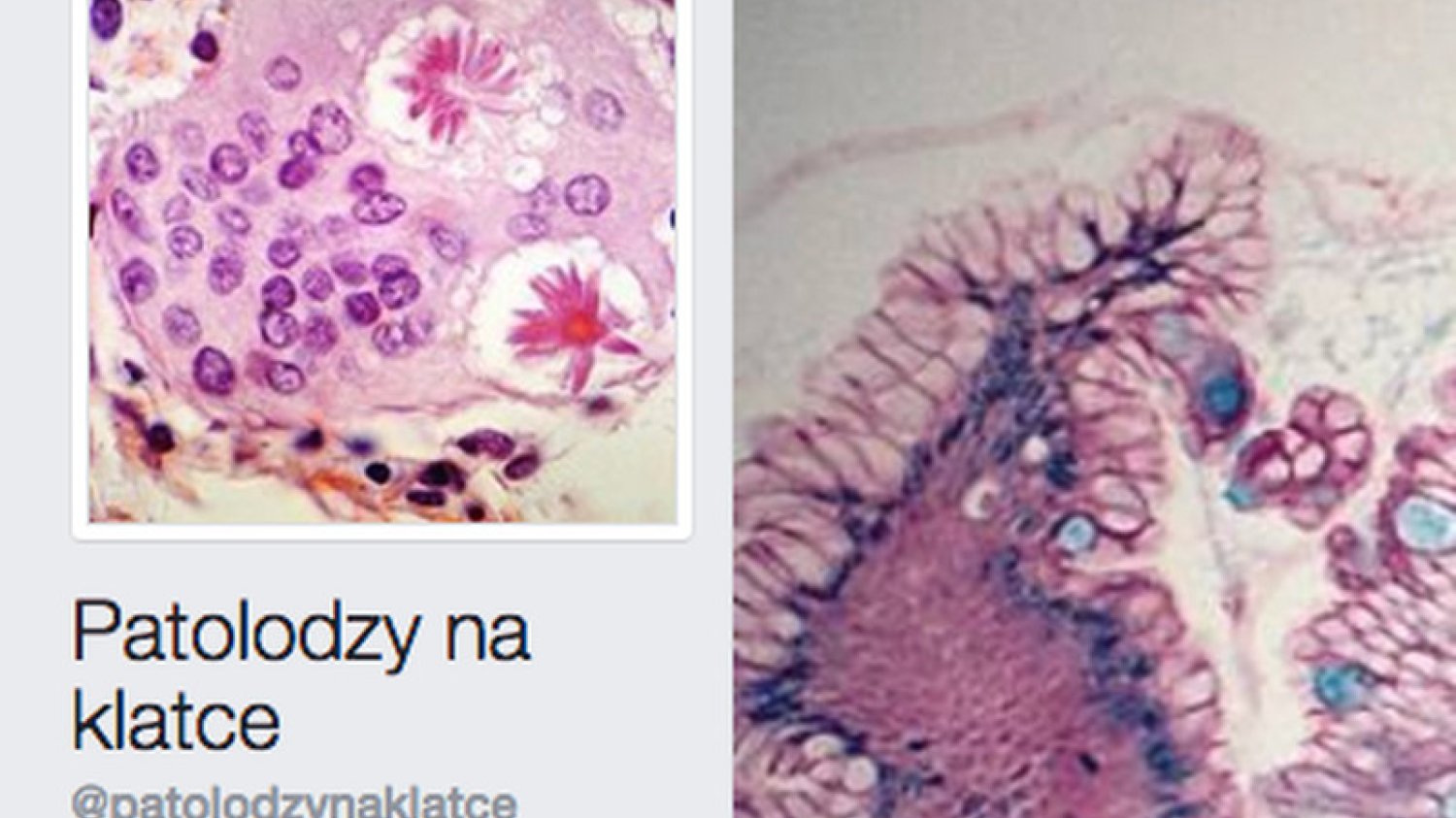 Obrazy chorych tkanek mogą być fascynujące.