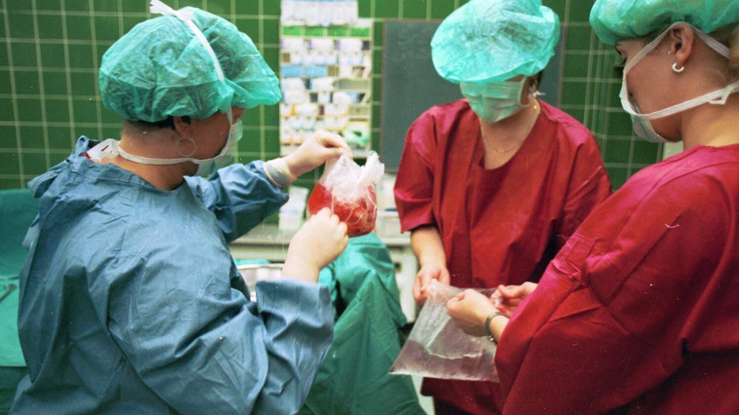 Transplantacja serca w Śląskim Centrum Chorób Serca w Zabrzu w 1997 r.