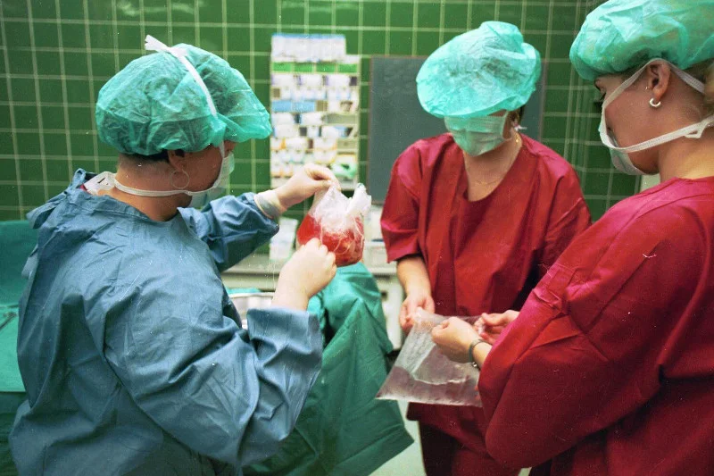 Transplantacja serca w Śląskim Centrum Chorób Serca w Zabrzu w 1997 r.