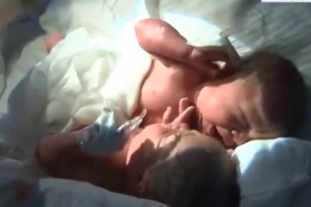 Janek i Dawid przed operacją. Kadr z nagrania wykonanego przez dr. Filipa Dąbrowskiego