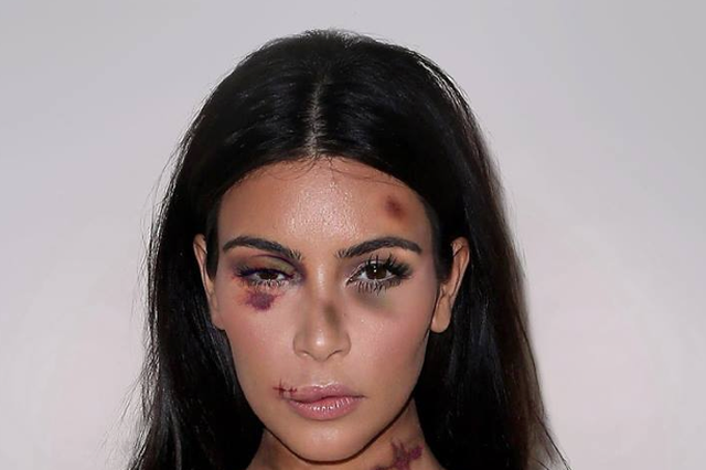 Pobita Kim Kardashian - takim zdjęciem artysta walczy z przemocą wobec kobiet
