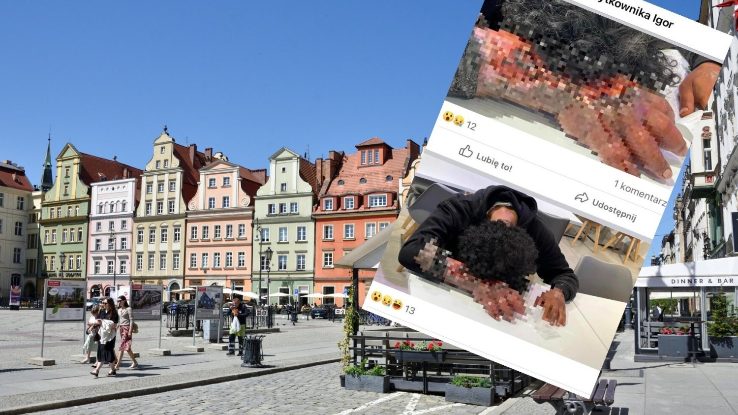 "Mężczyzna z gnijącą ręką" we Wrocławiu.