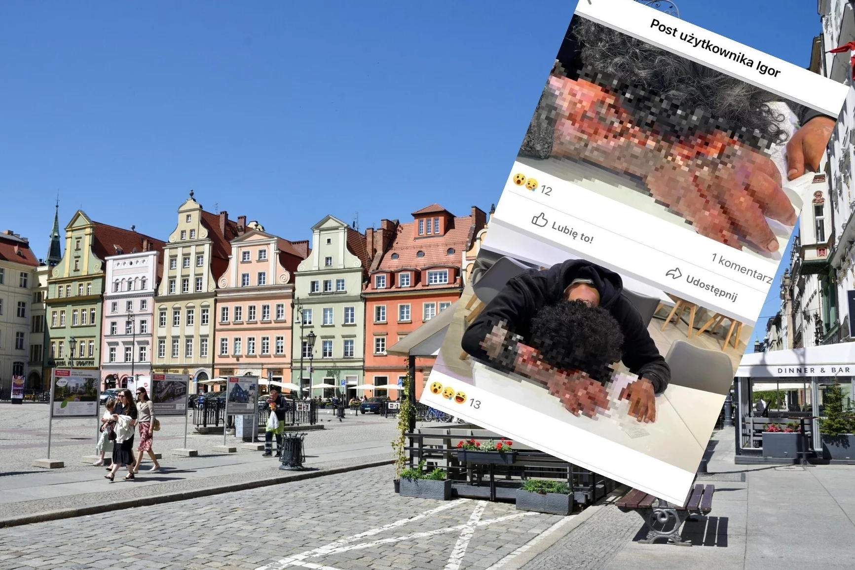 "Mężczyzna z gnijącą ręką" we Wrocławiu.