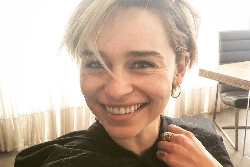 U aktorki wykryto tętniaka mózgu. Niezbędna była operacja.