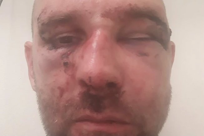 Przemysław Witkowski opowiedział o swoim pobiciu w TVN24.