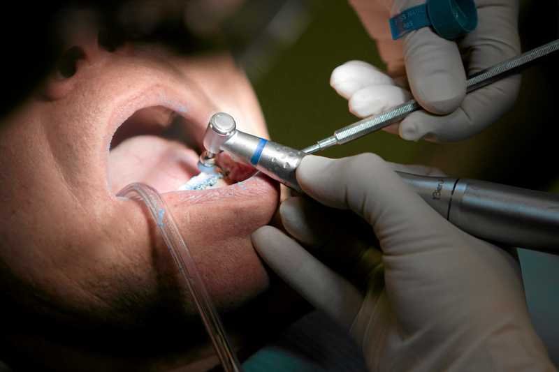 W porównaniu z innymi Europejczykami, Polacy najbardziej boją się dentysty.