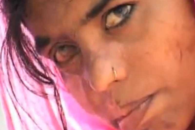 Dziewczynka z twarzą zniekształconą po oblaniu kwasem. Kadr z filmu dokumentalnego Acid Survivors Foundation