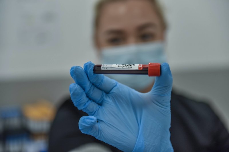 Ministerstwo Zdrowia opublikowało nowy raport o koronawirusie.