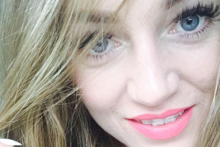 Tabloid dotarł do raportu medycznego.